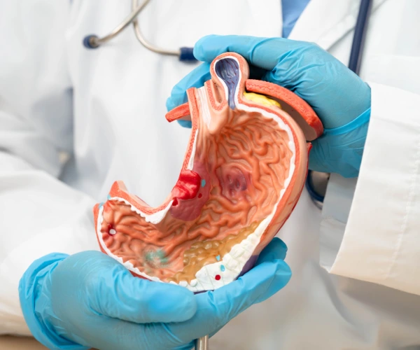 Medico gastrointestinal en naucalpan de juarez